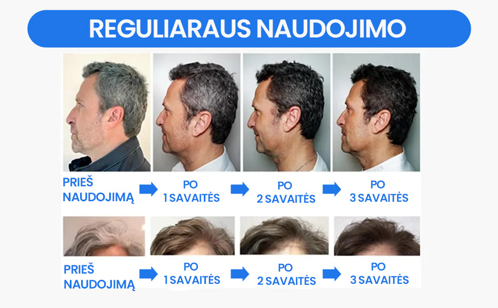 Muilas neutralizuojantis žilus plaukus