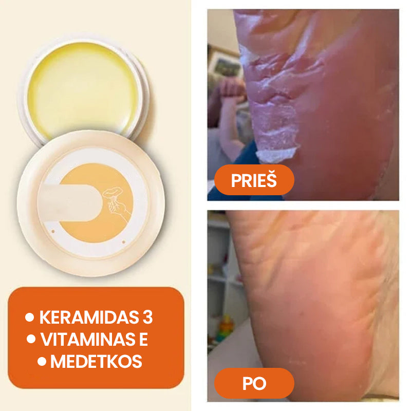 Kremas sausai, sutrūkinėjusiai odai (5 vnt.)