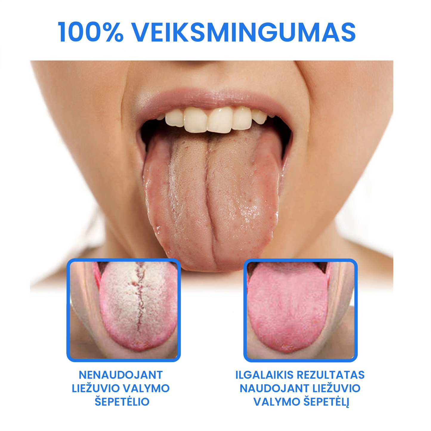 Liežuvio valymo rinkinys