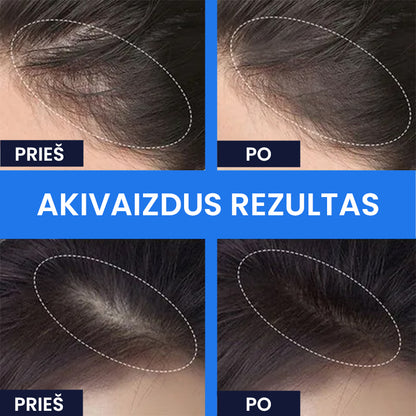 Obligatione™ - išretėjusių plaukų maskuoklis